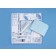 Busse Hospital Disposables, Inc. 651 Basic Biopsy Tray, Sterile, Includes: 25G x 5/8" Needle, 3cc Syringe, 22G x 1½" & 20Gg x 1½' Needles, 6cc & 20cc Luer Lock Syringe, 5mL Lidocaine, Scalpel, 2-10mL Spec. Vials, 6 Microscope Slides, 6" Ruler, 2 Sponge St