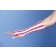 Medi-Tech International Corp MTSCGR02 Surgi-Color Guard Patient Safety Elastic Net Retainer, Latex-Free, 25yds Stretched, Red/White, Size 2, Stretches To 7" Circumference