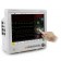 MDPro IM80.S.T PatIent MonItor 15 Inch Touch Screen NIBP, ECG, SpO2, Resp,Temp, EtCO2 (LoFlo) (PrInter OptIonal) (DROP SHIP ONLY) (Not Available For Sale into Canada)