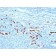 Calgranulin B / MRP-8/-14 / MAC 387 / S100A8/A9 / Macrophage Ag(MAC387), CF640R conjugate, 0.1mg/mL