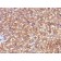 AFP (Alpha Fetoprotein)(C2), CF640R conjugate, 0.1mg/mL