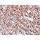 Carbonic Anhydrase IX(CA9/781), CF640R conjugate, 0.1mg/mL