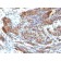 Caldesmon, HMW (h-Caldesmon)(CALD1/820), CF640R conjugate, 0.1mg/mL