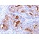 Carcinoembryonic Antigen (CEA) / CD66(C66/1260), CF640R conjugate, 0.1mg/mL