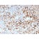 HSV1 (Herpes Simplex Virus Type I)(N/A), CF640R conjugate, 0.1mg/mL