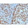 ZAP70 (Chronic Lymphocytic Leukemia Marker)(ZAP70/2047), CF640R conjugate, 0.1mg/mL