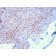 p73 (Tumor Suppressor)(P73/2531), CF640R conjugate, 0.1mg/mL