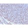 NKX2.2 (Neuroendocrine & Ewing's Sarcoma Marker)(NX2/2198R), CF647 conjugate, 0.1mg/mL