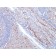 GLUT-1 (Tumor Progression and Mesothelioma Marker) (GLUT1/2476), CF568 conjugate, 0.1mg/mL