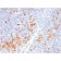 IL3RA / CD123 (Acute Myeloid Leukemia Marker)(IL3RA/2947R), CF568 conjugate, 0.1mg/mL