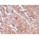 MUC1 / CA15-3 / EMA / CD227 (Epithelial Marker)(MUC1/2980R), CF568 conjugate, 0.1mg/mL