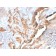 Tenascin C (Stromal Marker For Epithelial Malignancy) (TNC/2981R), CF568 conjugate, 0.1mg/mL