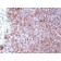 Lymphocyte Specific Protein 1 (LSP1) / pp52(LSP1/3025), CF568 conjugate, 0.1mg/mL