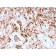 Ferritin, Light Chain (Node-Negative Breast Tumor Prognostic Marker)(rFTL/1388), CF568 conjugate, 0.1mg/mL