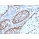 Nucleophosmin (Acute Myeloid Leukemia Marker)(NPM1/1902), CF740 conjugate, 0.1mg/mL