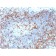ZAP70 (Chronic Lymphocytic Leukemia Marker) (ZAP70/2046), CF740 conjugate, 0.1mg/mL