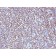 ALK (Anaplastic Lymphoma Kinase) / CD246(ALK/1504), CF594 conjugate, 0.1mg/mL