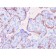MMP3 (Marker of Metastasis and Rheumatoid Arthritis)(rMMP3/1730), CF594 conjugate, 0.1mg/mL