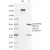 HER-2 / CD340(HRB2/718), Biotin conjugate, 0.1mg/mL