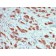 MUC1 / CA15-3 / EMA / CD227 (Epithelial Marker) (MUC1/1887R), Biotin conjugate, 0.1mg/mL