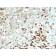 NGF-Receptor (p75) / CD271 (Soft Tissue Tumor Marker) (NGFR/2550R), Biotin conjugate, 0.1mg/mL
