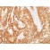 EGFRvIII (Epidermal Growth Factor Receptor, Variant III) (GFR/2600R), Biotin conjugate, 0.1mg/mL