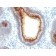 CD66 (CEA)(C66/1009), 0.2mg/mL