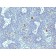 HPV-18 (Human Papilloma Virus 18)(HPV18/1297), 0.2mg/mL
