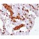 Napsin A (Lung Adenocarcinoma Marker) (rNAPSA/1239), 0.2mg/mL