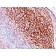 CD35 / CR1(E11), 1mg/mL