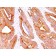 Cytokeratin, pan(AE-1 / AE-3), 1mg/mL