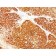 Melanoma Marker(HMB45 + A103 + T311), 1mg/mL