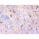 TNF alpha(TNF706 + P/T2), 1mg/mL