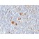CD30(Ki-1/779), 1mg/mL