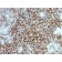 Melanoma Marker(KBA.62), 1mg/mL