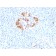 Ferritin, Light Chain (Node-Negative Breast Tumor Prognostic Marker)(FTL/1387), 1mg/mL