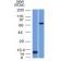 MMP2 / Collagenase Type IV A (Tumor Metastasis Marker) (MMP2/1501), 1mg/mL