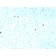 HPV-16 (Human Papilloma Virus 16) (rHPV16L1/1058), 1mg/mL