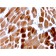 Sarcomeric Actinin Alpha 2 / ACTN2(ACTN2/3292), 1mg/mL
