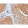PAI-RBP1 / SERBP1 / SERPINE1(SERBP1/3497), 1mg/mL