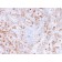 Biotium BNUM3781-50, Calprotectin / MRP14 / S100A9 / Calgranulin B(rMAC3781), 1mg/mL