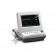 Avante Health Solutions 60134T Compact FM, 6" Color Display (DROP SHIP ONLY) (Freight Terms are Prepaid & Add to Invoice-Contact Vendor for Specifics)