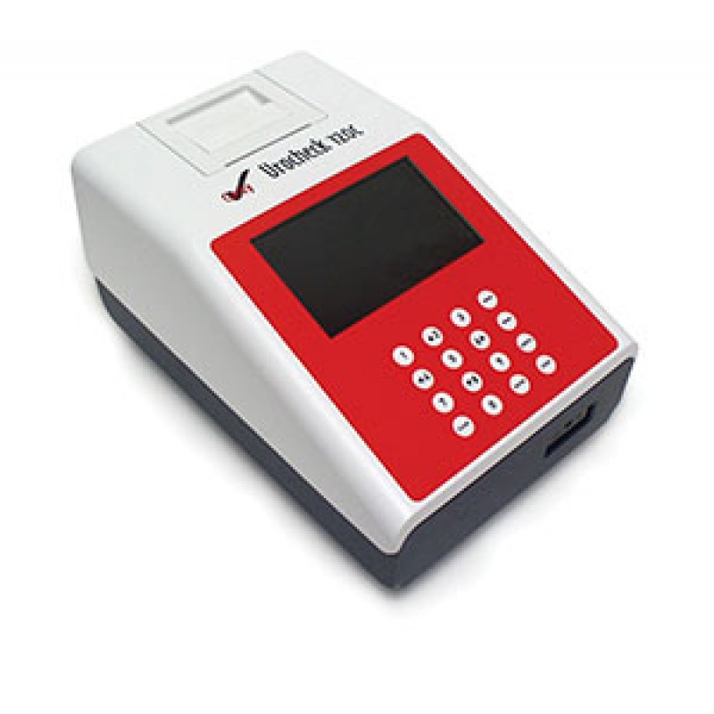 Clarity Diagnostics, LLC CLA-U120C Clarity Urocheck 120C Urine Analyzer, Small Footprint Analyzer, CLIA Waived, Large LCD Display, Up to 120 Tests Per Hour, Flagging for Abnormal Results, 2000 Test Internal Memory, Automatic Paper Feeder, USB & RS232 Port