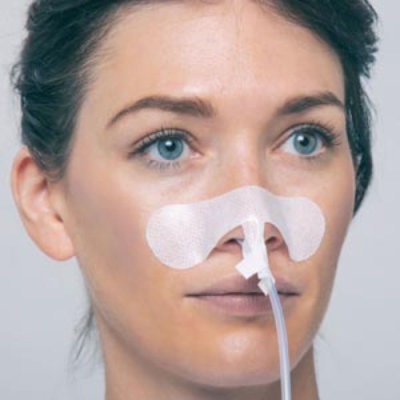 TIDI Products, LLC 3401LNG Securement Device, Nasal Gastric Tube, Large, Sterile, Individually Packaged, 100/bx