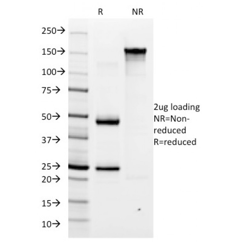 Helicobacter pylori(HP/1335), CF405S conjugate, 0.1mg/mL