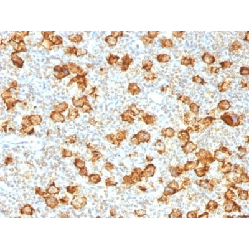 CD30 / TNFRSF8 (Hodgkin & Reed-Sternberg Cell Marker) (Ki-1/1505R), CF405S conjugate, 0.1mg/mL