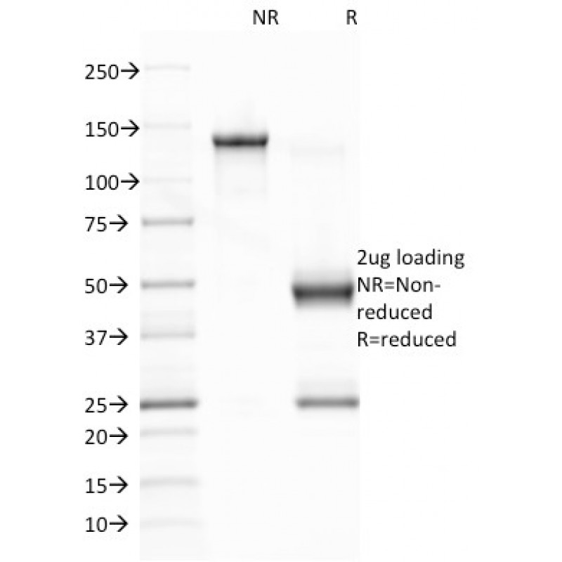Epstein-Barr Virus (LMP-1)(CS1), CF405S conjugate, 0.1mg/mL