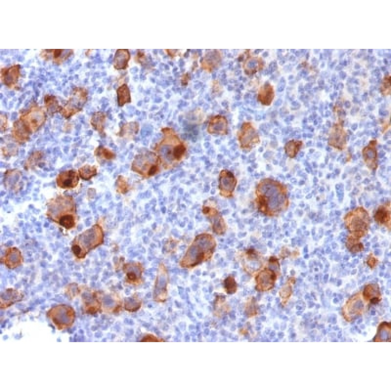 CD30 / TNFRSF8 (Hodgkin & Reed-Sternberg Cell Marker) (Ki-1/1747R), CF405S conjugate, 0.1mg/mL
