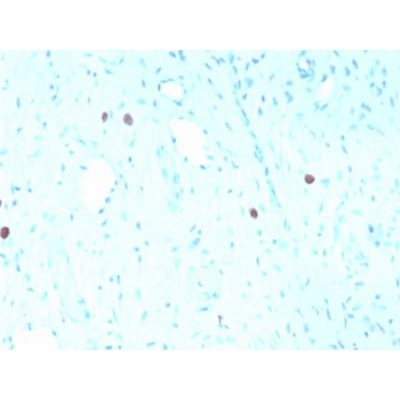 HPV-16 (Human Papilloma Virus 16) (rHPV16L1/1058), CF405S conjugate, 0.1mg/mL