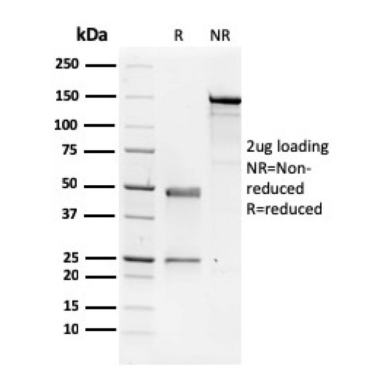 NME1 / nm23-H1 / NDPK-A (Suppressor of Metastasis)(CPTC-NME1-2), CF405S conjugate, 0.1mg/mL